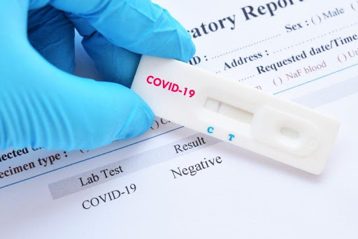 Antigenski testovi na Covid-19 od sada dostupni i uz plaćanje
